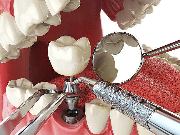 Fast & Reliable Emergency Dental Services in OR